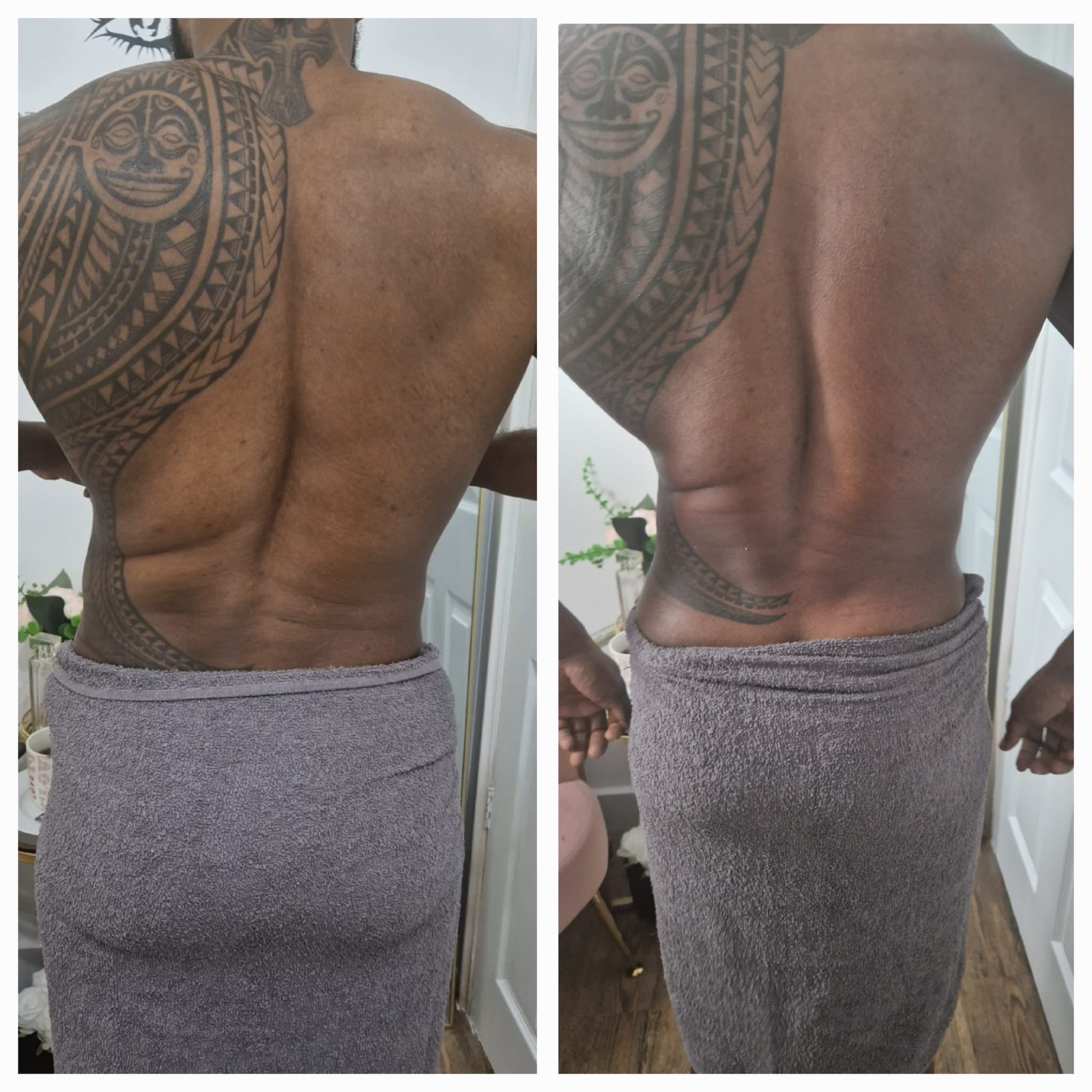 client after powersculpt treatment